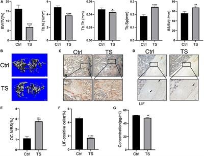 Osteoblast and Osteoclast Activity Affect Bone Remodeling Upon Regulation by Mechanical Loading-Induced Leukemia Inhibitory Factor Expression in Osteocytes